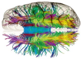 La estructura más compleja del universo pesa menos de dos kilogramos