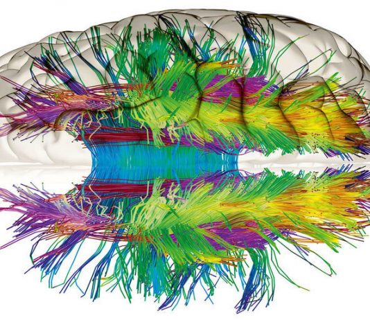 La estructura más compleja del universo pesa menos de dos kilogramos