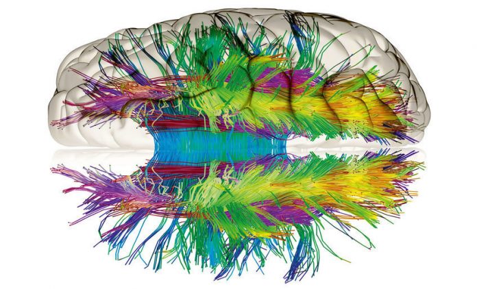 BRAIN1