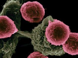 Revelan “hibernación” de células de cáncer para evadir quimioterapia