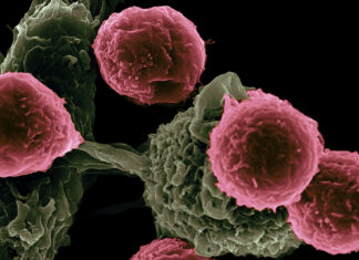 Revelan “hibernación” de células de cáncer para evadir quimioterapia