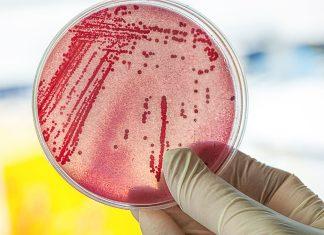 Aumentan casos tras brote de E.Coli en guarderías