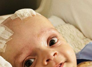 El costo que pagamos por la salud