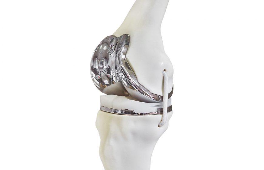 El grafeno: el material que está redefiniendo la ciencia y la economía del siglo XXI